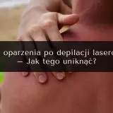 Depilacja laserowa a solarium: Ile czekać? Uniknij poparzeń!