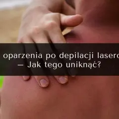 Depilacja laserowa a solarium: Ile czekać? Uniknij poparzeń!