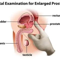 Masaż prostaty: Instrukcja dla zdrowia i przyjemności. Jak zacząć?