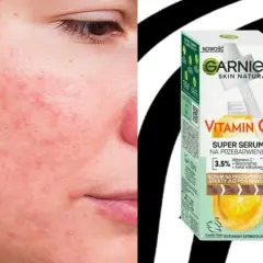 Co daje serum z witaminą C? Rozjaśnij przebarwienia, ujędrnij skórę!