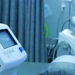 Jaki laser do depilacji? Porównanie, koszty, efekty i wybór
