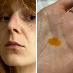 Twarz kobiety z piegami i kropla serum w dłoni.
