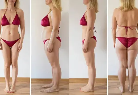 Liposukcja: Jak wygląda zabieg? Pełny przewodnik i rekonwalescencja