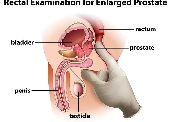 Masaż prostaty: Instrukcja dla zdrowia i przyjemności. Jak zacząć?
