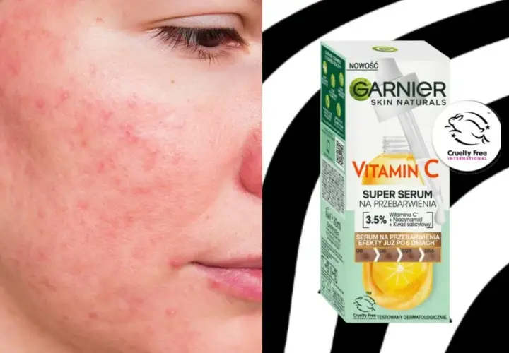 Co daje serum z witaminą C? Rozjaśnij przebarwienia, ujędrnij skórę!