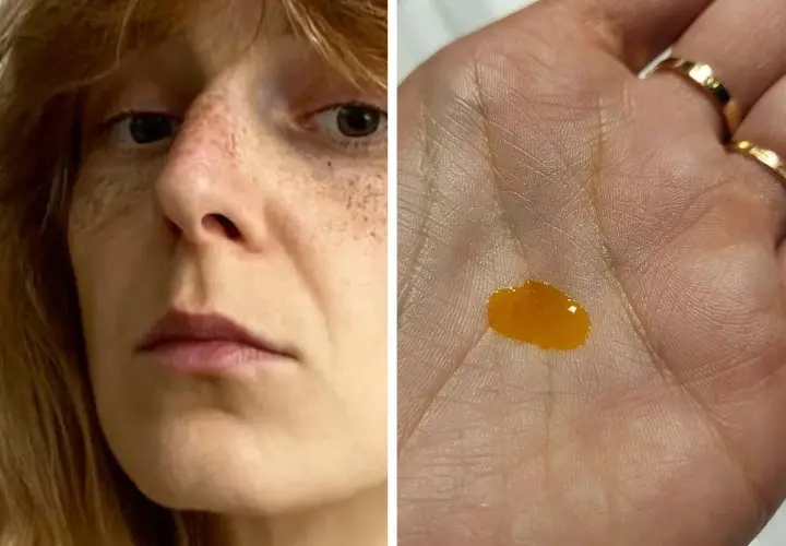 Twarz kobiety z piegami i kropla serum w dłoni.