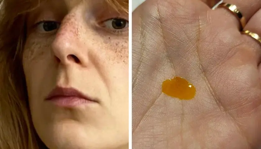Twarz kobiety z piegami i kropla serum w dłoni.