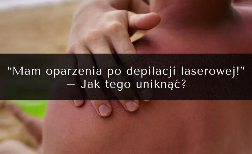 Depilacja laserowa a solarium: Ile czekać? Uniknij poparzeń!