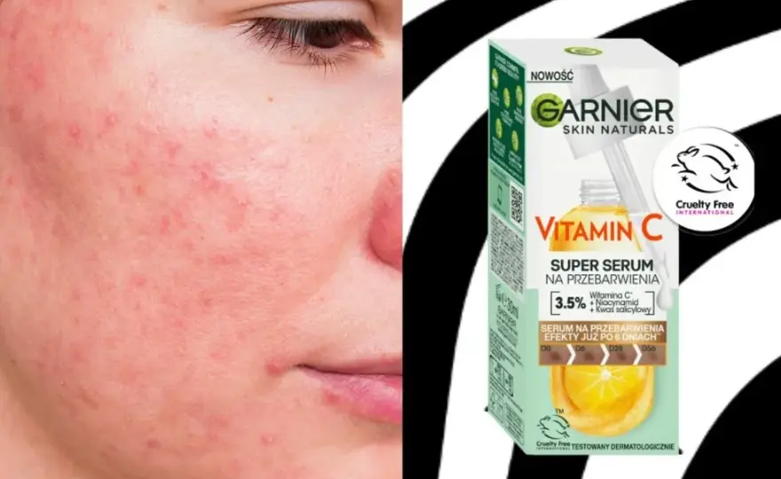 Co daje serum z witaminą C? Rozjaśnij przebarwienia, ujędrnij skórę!