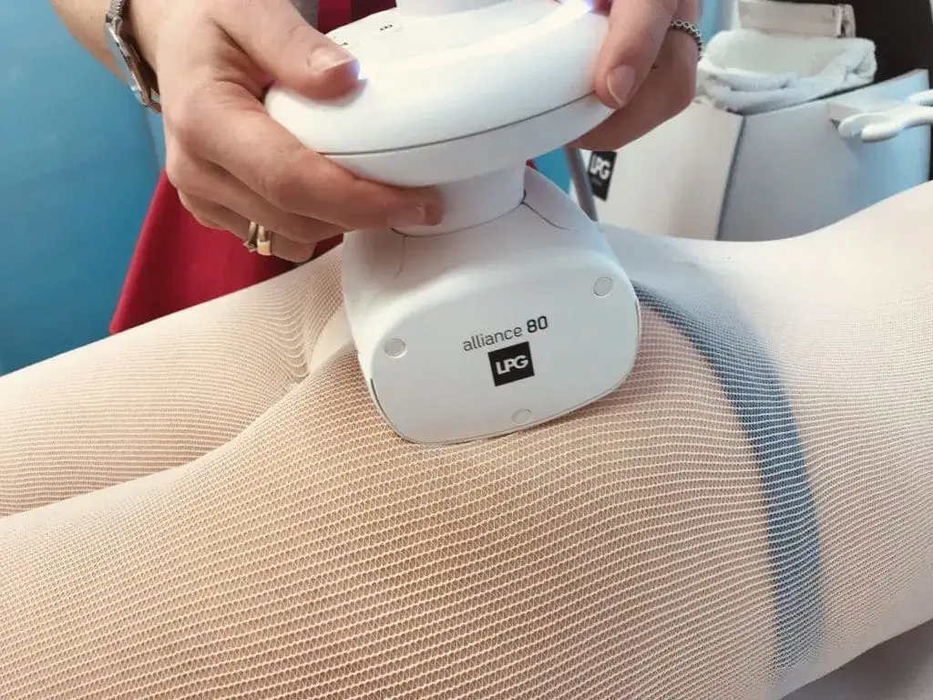 LPG Alliance urządzenie endermologia